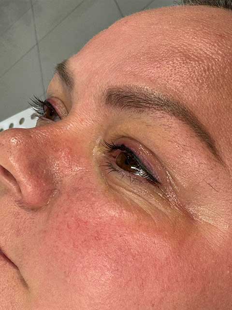 Paraffin therapy process